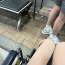 A080 | 전거비인대·종비인대 완전 파열 비수술치료 후기 (결혼식 D-30, 고대안암병원 응급실, CM병원, 반깁스...