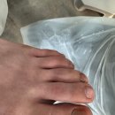레푸스앤두두뷰티 | 의정부레푸스호원점 레푸스 앤 두두뷰티에서 관리받고 편해진 발 상태👣