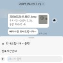 정만빙수 | 《임신준비기 39》 시험관 2차(=동결이식 1차) - 동결이식 후 일상 1탄, 프로게스테론 피검사 결과