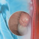 이노메디 이미지