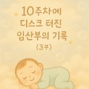 참편한 보조기 | 10주차에 디스크 터진 임산부의 기록 (3부)