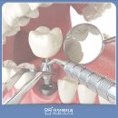 맥치과기공소 이미지