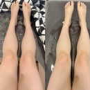 토탈정비 | 천안 바디관리 ｜ 샵토탈뷰티살롱 하체관리 리얼 후기