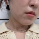 비앤에스 | 삼성동 인모드 잘하는 삼성비앤에스의원 내돈내산 후기(인모드+입꼬리보톡스 후기)