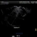 이정례의원 이미지