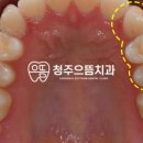 청주으뜸치과 이미지