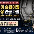 크로스핏STABLE | Case Review_178- 몇일 전 발생한 염좌 부상 이후 지속적인 무릎 통증과 부종이 있는 46세 남자- Bucket...
