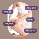 투썸플레이스대전만년점 | 💖 명절&휴가 뒤 ‘급찐살’ 고민 - '이지슬림 대전다이어트 둔산점'에서 찐-해결! ✨