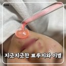 진월동 피부관리 턱 인중 여드름해결 윤슬 솔직후기
