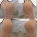 씨네일엔레푸스롯데마트제주점 | [제주발각질] "제주여행 중 만났어요!" 일본인 관광객...갈라진 뒤꿈치 긴급 소생 후기 (레푸스제주점)