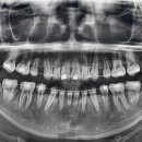 서울안아프게치과의원 이미지