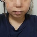 (주)모드 | 홈모드 9주차 리얼 후기 🌟리쥬샷 HB+ 주 3회 루틴으로 물광피부 완성