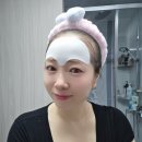 에이지솔루션 | 이마&미간 주름 한 번에 관리! 라보타치 티존 에이지 패치 솔직 후기