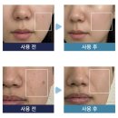 루아셀 | 엑소좀재생크림&4세대 스피큘의 효과 [루아셀 후기]