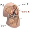 자전거 통증 이미지