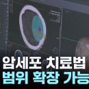 뇌종양 &#39;교모세포종&#39;이 이제는 완치까지 내다볼 수 있게 됐습니다. 이미지