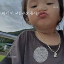 부마치과 | 18개월 아기 턱 봉합수술후기 &amp; 100일 뒤 흉터 변화