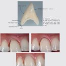 철산이편한치과의원 | 가산디지털단지 철산 교정 치과 가지런함이 전부가 아닌 이유