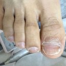 레푸스 구로점 | 천왕동 개봉동발톱무좀 고민이나 찾으시는분들은 레푸스신도림