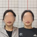 생활에너지 연구소 | [언주/학동] 관리에 진심인 30대 여성의 “김도영 체형관리 연구소” 논현동 얼굴라인관리 후기