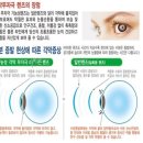 안경매니져 첨단산월점 이미지