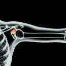 호원본튼튼의원 이미지