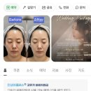 수메르뷰티 | 수성구 웨딩관리 고민이라면? 대구 웨딩관리 수메르뷰티 예신관리 솔직후기