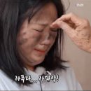 다나한의원 | 전주 리프팅 후기, 30대 탄력을 위한 매선 시술 후기 (내돈내산)