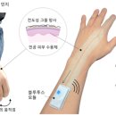 비트휴비츠