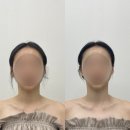 반월당네거리 | [대구/반월당] 윤곽•데콜테 마사지 제이스킨| 대구 피부관리 에스테틱| 승모근 관리| 드레스 라인 만들기