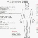 비오틴 결핍증 효과 살펴보죠 이미지