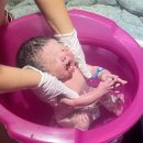 NR-6[양수로]-하-2 | 김포나리병원✨ 제왕절개 후기#2 (제왕절개 후기 및 6박7일 입원생활(입원-2일차)