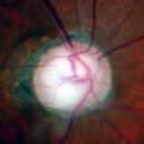 스마트메디컬 이미지