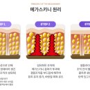 스키니바디 네이버블로그