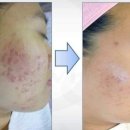 피부에설레다 이미지