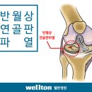 반월상연골판파열의 치료와 관절경수술 잘하는곳의 수술방법 이미지