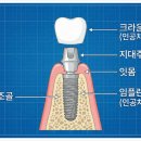 본치과기공소 이미지