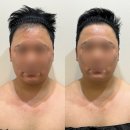 설아미 | 설아미 의정부피부관리 설아미 의정부본점에서 경험한 윤곽관리 후기✨