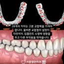 열린치과 이미지