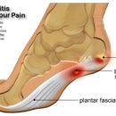 무척바른한의원 이미지