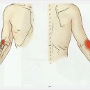 손,손목,팔꿈치 근막통증유발점 [상완요골근,수근신근,수근굴근] 이미지