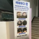 우태자헤어라인 | 잠실 두피문신 색채우다 앞머리 헤어라인 SMP 1회차 내돈내산 후기