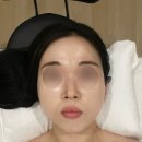 의정부 피부관리 비움에스테틱 | 시그니처 풀페이스 관리 솔직 후기