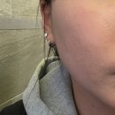 주식회사 마이크로바이옴헬스 | 마녀공장 비피다 바이옴 콤플렉스 앰플 내돈내산, 피부장벽 변화 솔직후기
