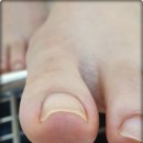 페디앤럭스네일 이미지