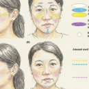 연세채움의원 | 고우리 시술 후기, 왜 같은 시술도 결과가 다를까요
