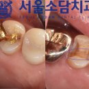 서울소담치과 이미지