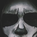정스킨