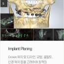 더웃는치과 이미지