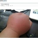 도라에몽 주먹으로 유명했던 디시인 근황 이미지